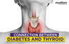 Connection Between Diabetes and Thyroid