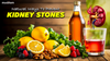 Natural Ways to Prevent Kidney Stones